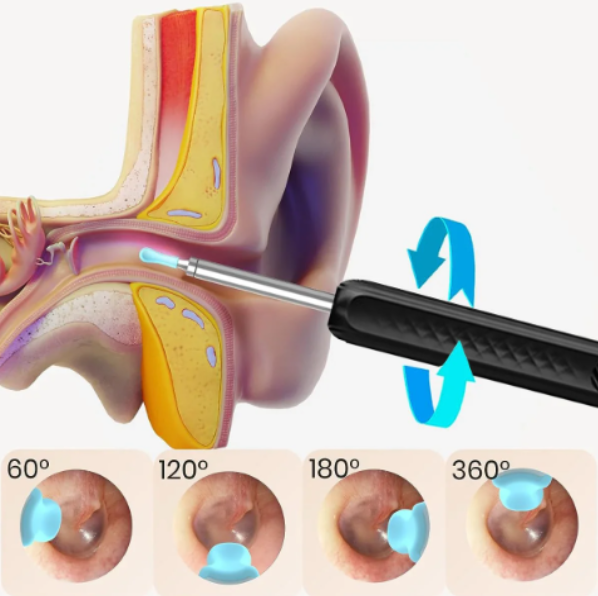 LIMPIADOR DE OÍDOS CON CÁMARA HD OBSEQUIO KIT 8 PIEZAS
