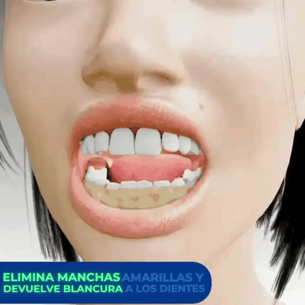 ¡FRETE GRATIS! SmileKit® (Crema dental blanqueadora)